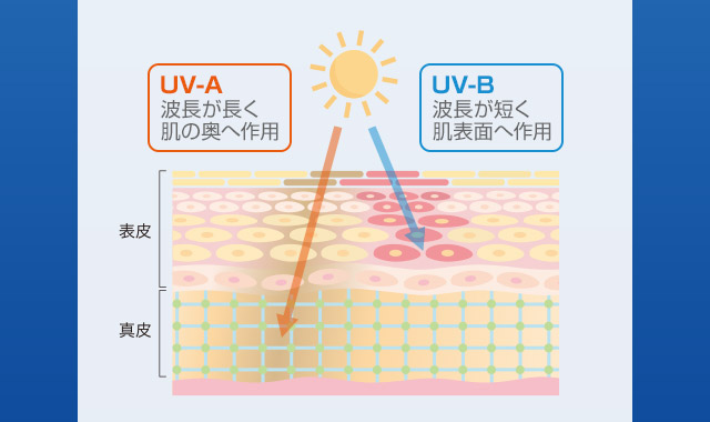 紫外線刺激のイメージ図